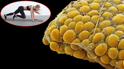 Grasso localizzato e grasso ostinato: uno studio testa lo Stubborn Fat Protocol