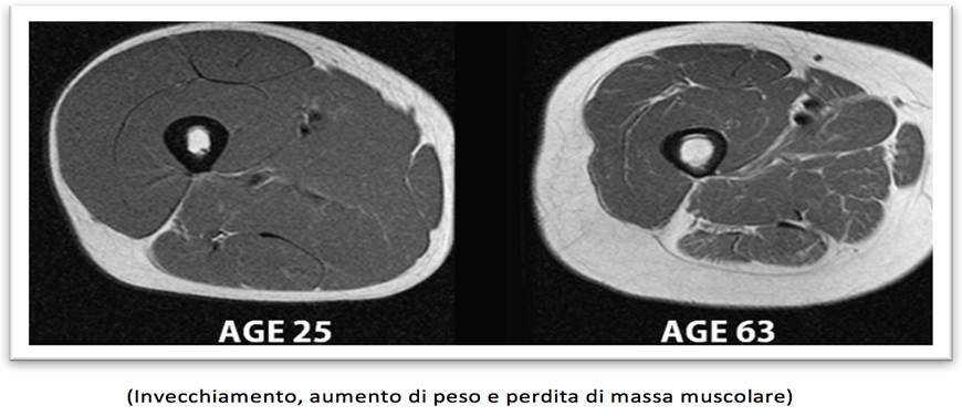invecchiamento muscolo grasso