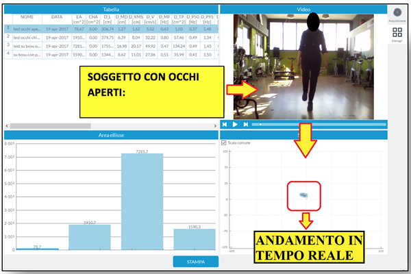 propriocezione anziani