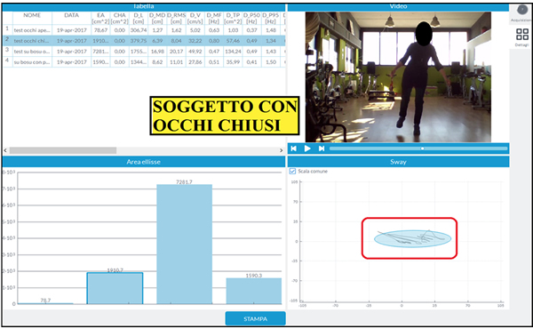 test propriocettivo anzini occhi chiusu