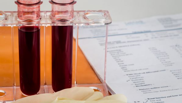 Leggere gli esami del sangue: trigliceridi, colesterolo HDL, glicemia