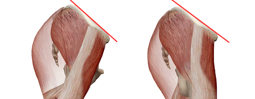 sedere in fuori o piatto anatomia