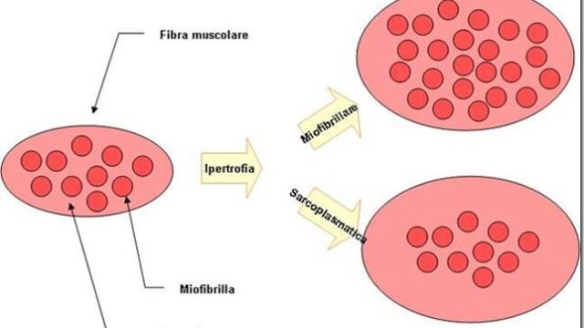 ipertrofia miofibrillare sarcoplasmatica