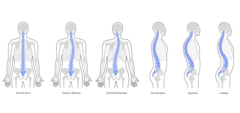 Colonna vertebrale: anatomia e funzioni - Project inVictus