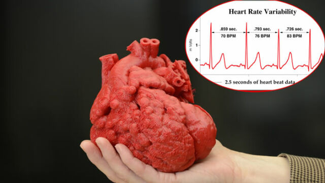 HRV