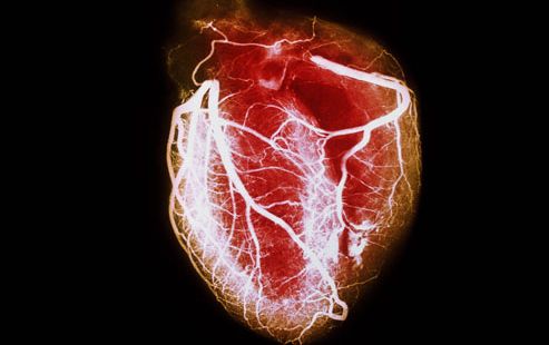 Allenare persone con malattie cardiovascolari