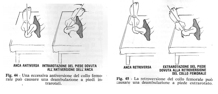 Piede e posizione del bacino