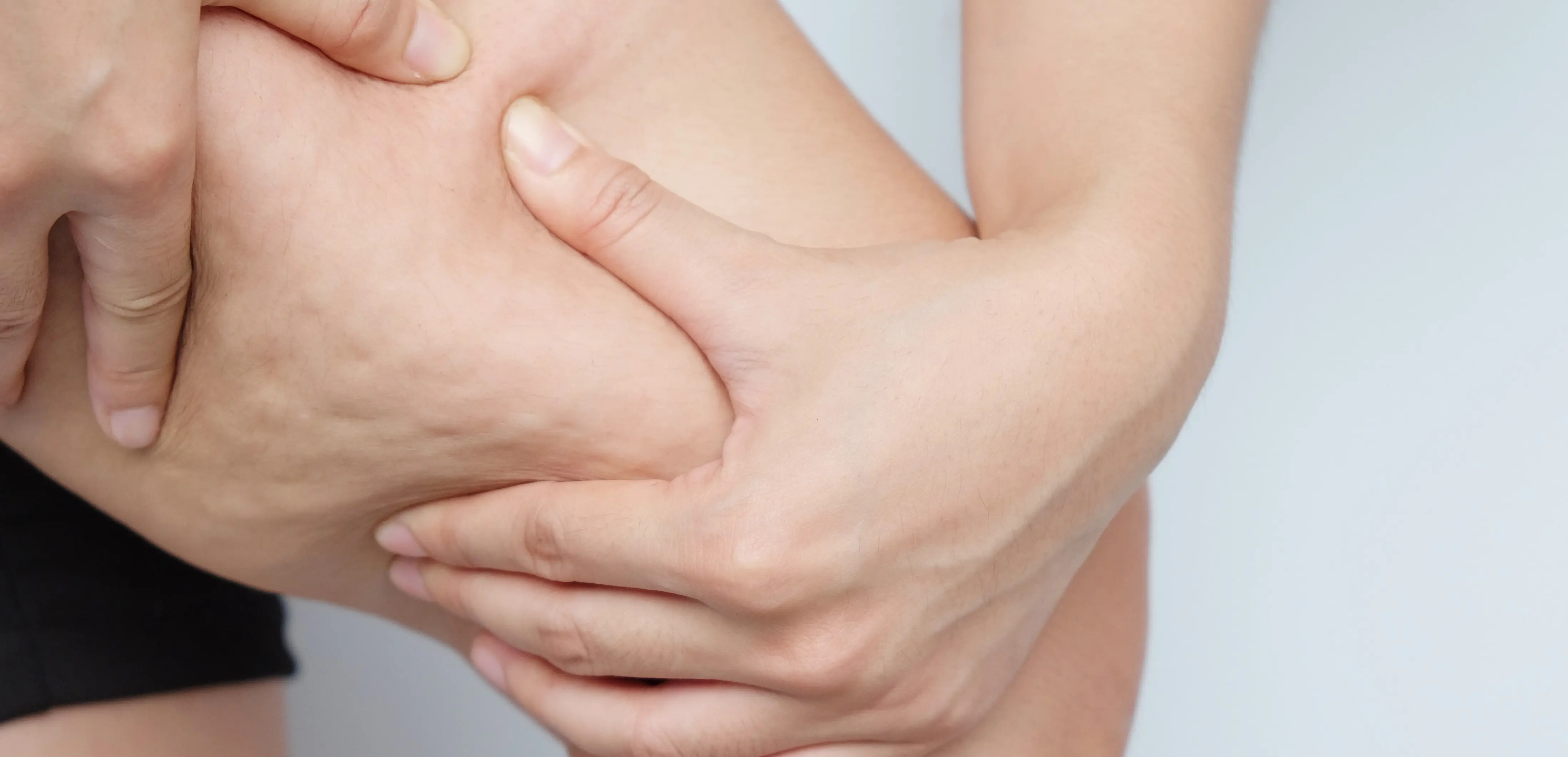 Grasso localizzato nelle donne e cellulite