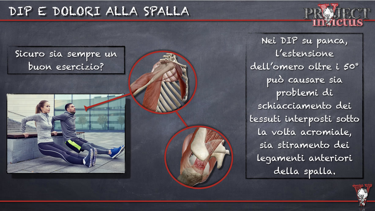 Dip Tra Panche Muscoli Attivi E Rischio Articolare Project Invictus