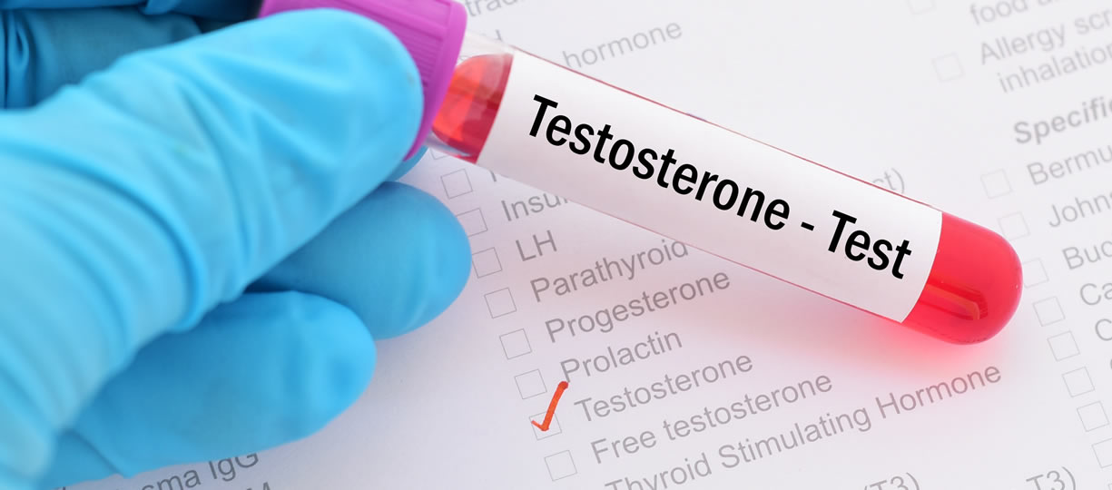 valori testosterone