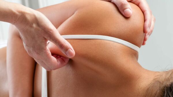 Scapole alate: cause, rimedi ed esercizi