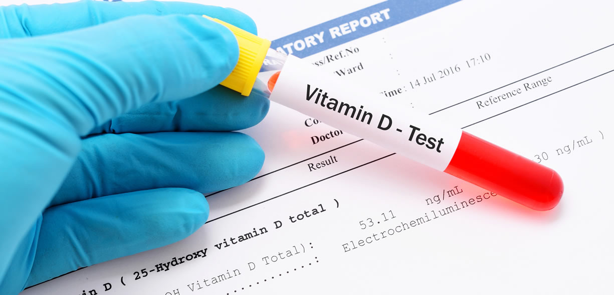 perché prendiamo multivitaminici perché prendiamo multivitaminici