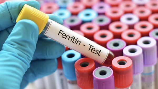 Ferritina: alimenti, livelli, consigli