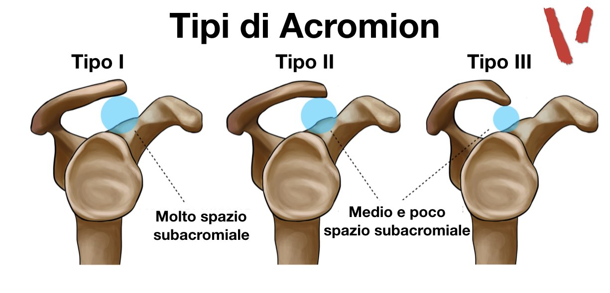 Tipi di acromion