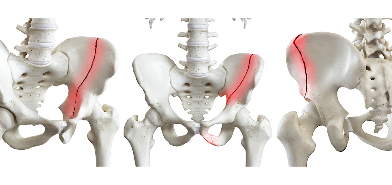 Fratture bacino 