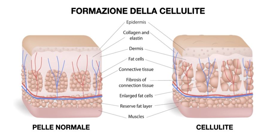 cellulite-e-palestra-allenamento-e-stretching-project-invictus
