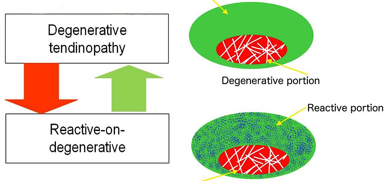 Continuum model 