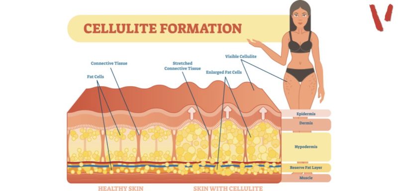 cellulite e cyclette